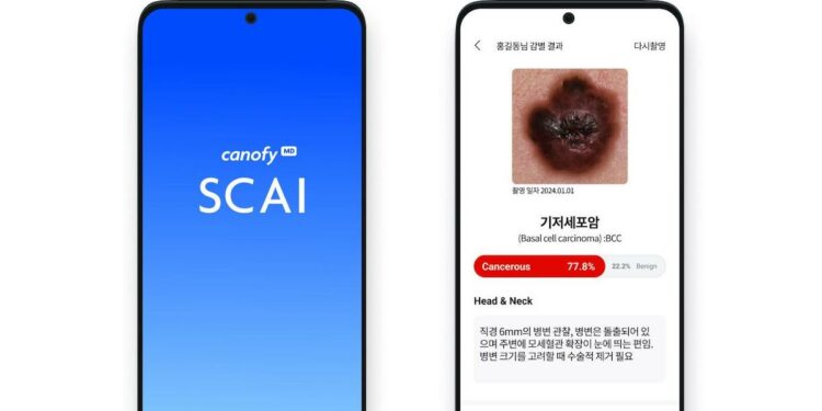 South Korea approves first local skin cancer detection AI
