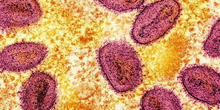 Philippines confirms two new mpox cases of milder variant