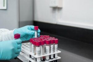 India recognises Nepali lab for fresh produce export testing – FreshPlaza