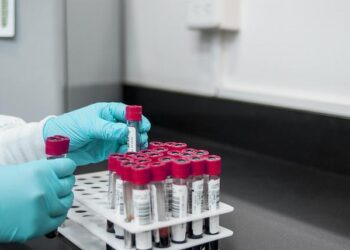 India recognises Nepali lab for fresh produce export testing – FreshPlaza