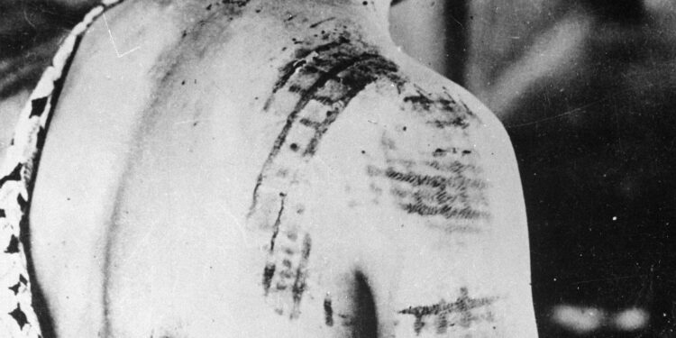 Hibakusha Groups Call on Japan to Attend Nuke Ban Treaty Meetings – nippon.com